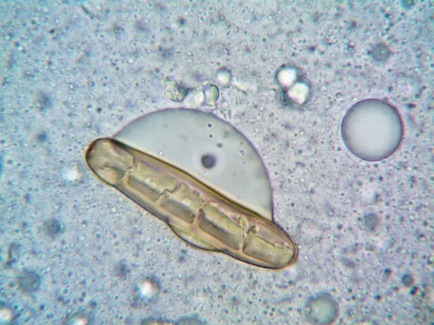 Antibiotique : Voici son effet sur une bactérie en détail
