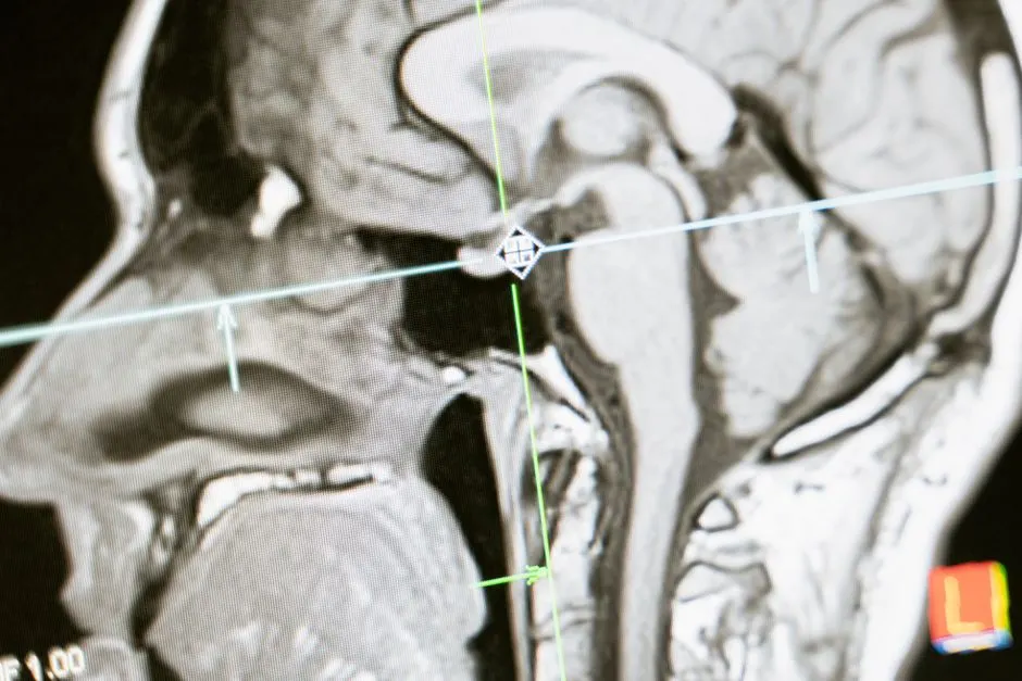 neurone artificiel communication
