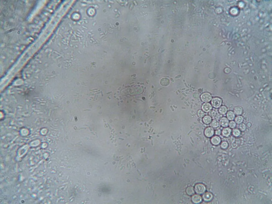 Vieillissement cellulaire : l’épuisement de nos cellules